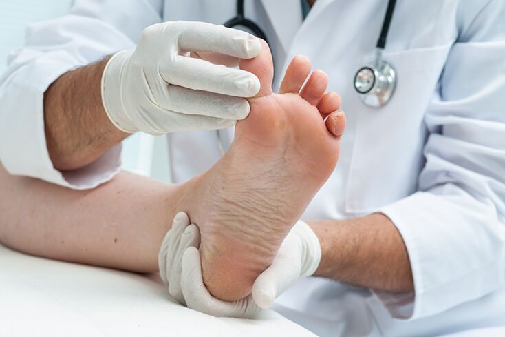 Dermatoloog uurib patsiendi jalgu